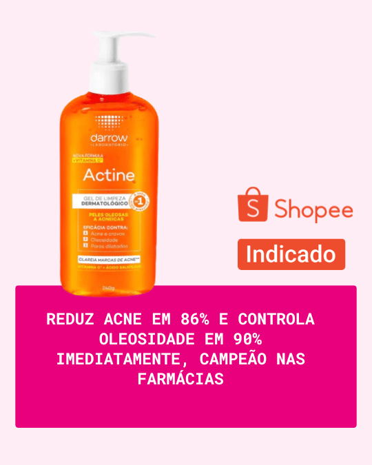 https://s.shopee.com.br/901WnWZ8hn